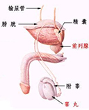精囊炎
