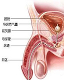 尿道炎